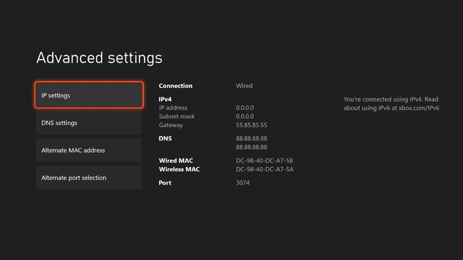 Nastavitve IP na Xbox Series X|S.