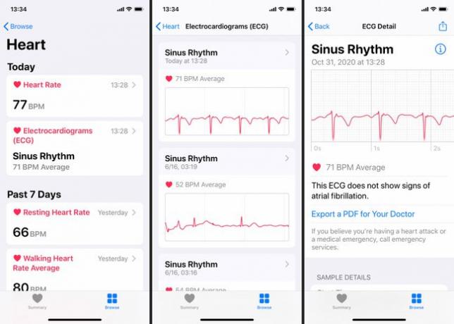 또한 쌍으로 연결된 iPhone의 건강 앱에서 ECG 결과를 볼 수 있습니다.