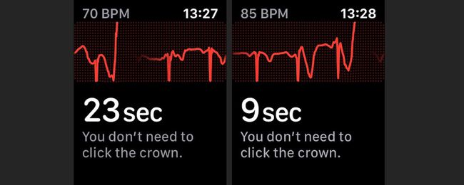 ECG 앱은 30초를 카운트다운합니다.